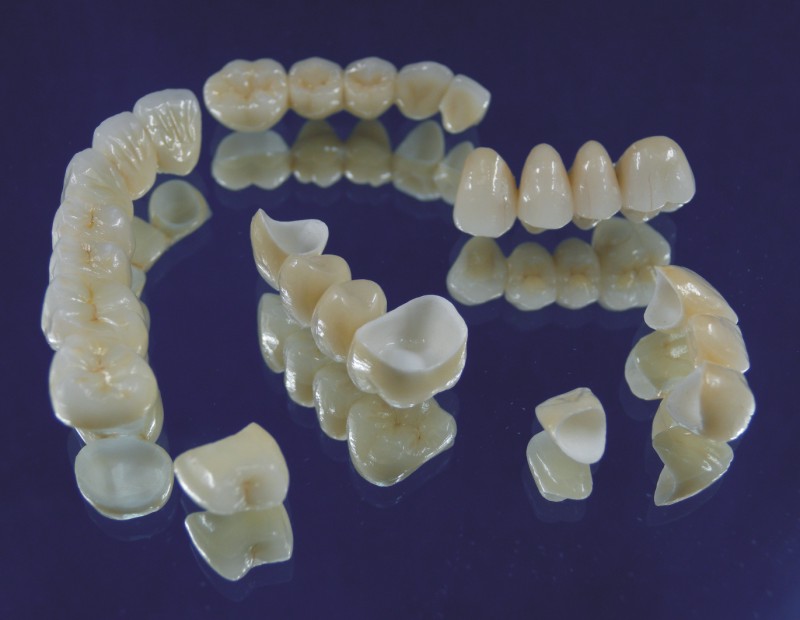 răng sứ cercon